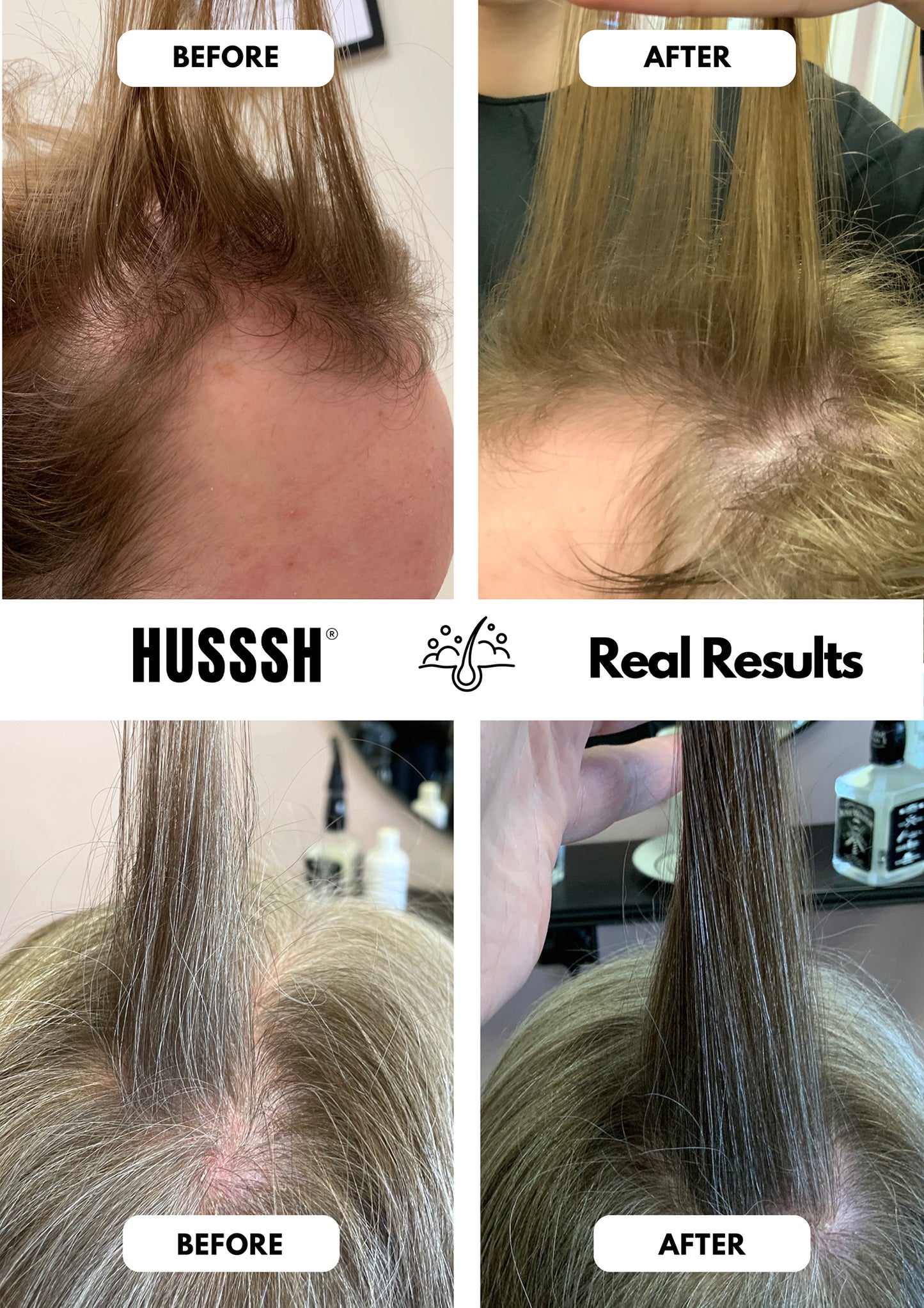 HUSSSH® Hair Recovery Shampoo for Reconstruction and Thickening